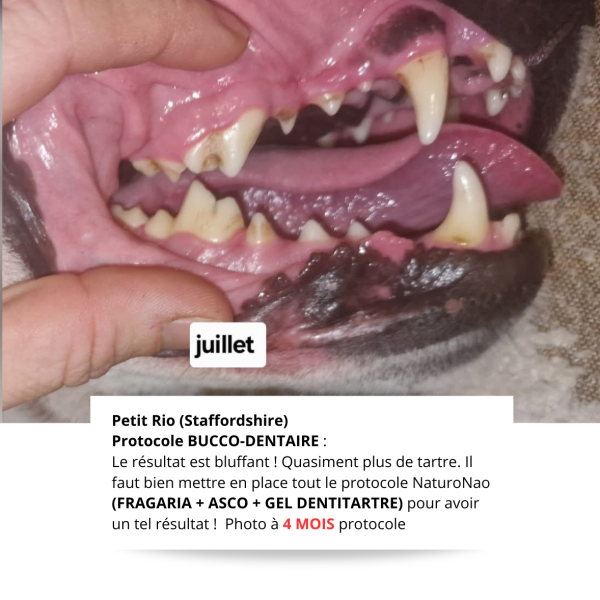 Photo témoignage à 4 mois du protocole bucco-dentaire NaturoNao (Fragaria V. + ASCO + Gel Dentitartre). Juste bluffant !