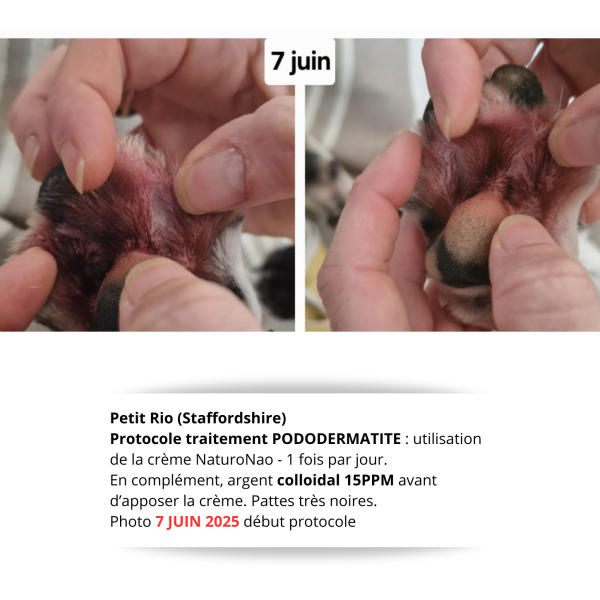 Témoignage début protocole soin PODODERMATITE (7 juin 2025)
